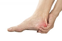 Heel Pain, Plantar Fasciitis, and Obesity May Be Connected